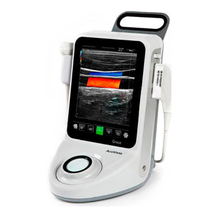 Фото товара УЗИ-сканер AcuVista Grace