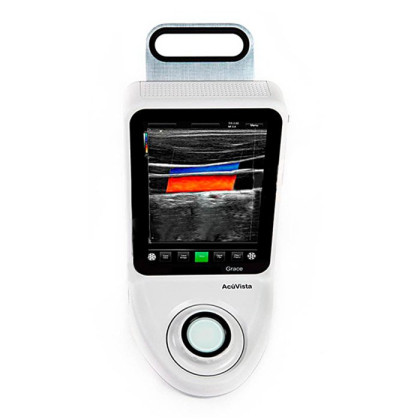 Фото товара УЗИ-сканер AcuVista Grace
