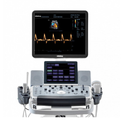 Ультразвуковой аппарат Mindray DC-55 Фото товара Ультразвуковой аппарат Mindray DC-55