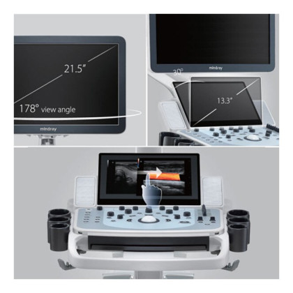 Ультразвуковой аппарат Mindray DC-60 Pro Фото товара Ультразвуковой аппарат Mindray DC-60 Pro