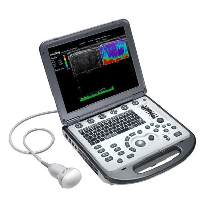 Ультразвуковой аппарат Mindray M6 Фото товара Ультразвуковой аппарат Mindray M6