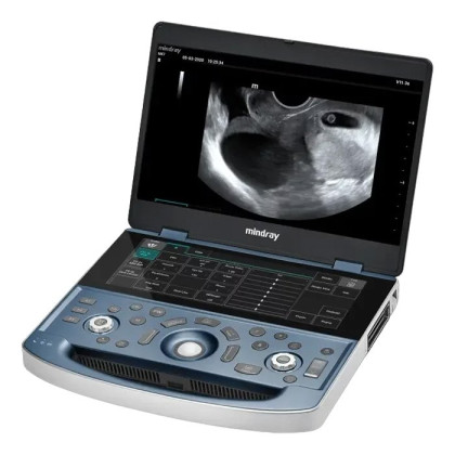 Ультразвуковой аппарат Mindray MX7 Фото товара Ультразвуковой аппарат Mindray MX7