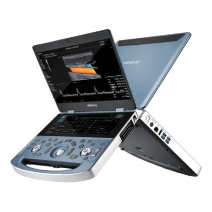 Ультразвуковой аппарат Mindray MX7 Фото товара Ультразвуковой аппарат Mindray MX7