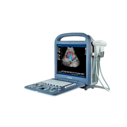 Ультразвуковой сканер S2 SonoScape Фото товара Ультразвуковой сканер S2 SonoScape