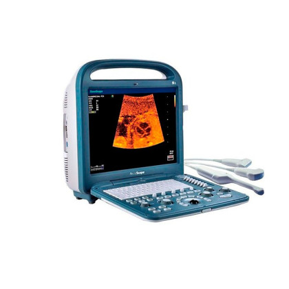 Ультразвуковой сканер S2 SonoScape Фото товара Ультразвуковой сканер S2 SonoScape