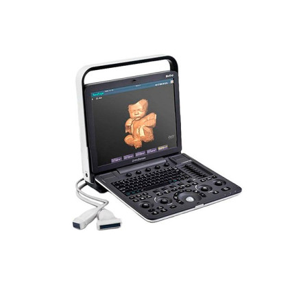 Ультразвуковой сканер S8Exp SonoScape Фото товара Ультразвуковой сканер S8Exp SonoScape