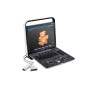 Ультразвуковой сканер S8Exp SonoScape Фото товара Ультразвуковой сканер S8Exp SonoScape