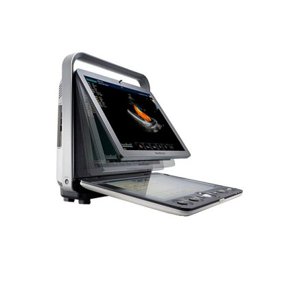 Ультразвуковой сканер S9 SonoScape Фото товара Ультразвуковой сканер S9 SonoScape