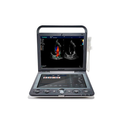 Ультразвуковой сканер S9 SonoScape Фото товара Ультразвуковой сканер S9 SonoScape