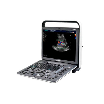 Ультразвуковой сканер S9Pro SonoScape Фото товара Ультразвуковой сканер S9Pro SonoScape