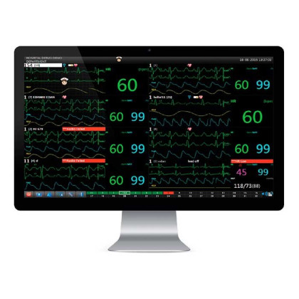 Центральная станция к прикроватным мониторам Диксион Фото товара Центральная станция к прикроватным мониторам Диксион