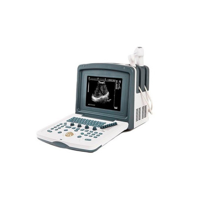 Цифровой УЗИ сканер АсuVista RS880f Россия, Литва Фото товара Цифровой УЗИ сканер АсuVista RS880f Россия, Литва