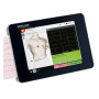 Фото товара Электрокардиограф 6/12-канальный Cardiovit FT-1 ETM (программа измерений и интерпретации)