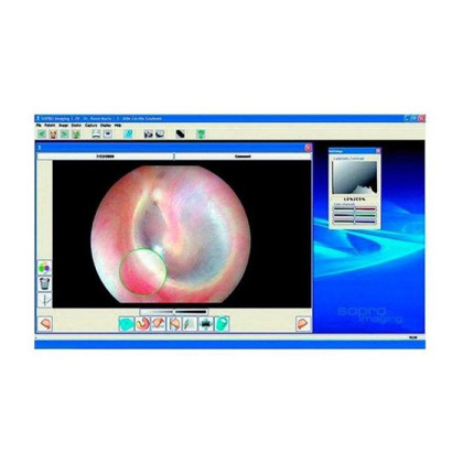 Эндовидеокамера SOPRO 181 UBICAM PLUS PAL: Видеокамера Ubicam + одна лицензия программы SOPRO IMAGING Medical + объектив Фото товара Эндовидеокамера SOPRO 181 UBICAM PLUS PAL: Видеокамера Ubicam + одна лицензия программы SOPRO IMAGING Medical + объектив